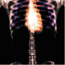 X-RAY SKELETON TORSO RIBS - ORIGINAL PHOTO CUT OUTS