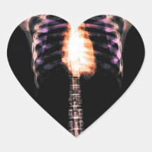 X-RAY SKELETON TORSO RIBS - ORIGINAL STICKERS