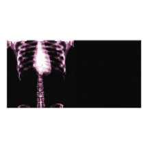 X-RAY SKELETON TORSO RIBS - PINK PERSONALIZED PHOTO CARD