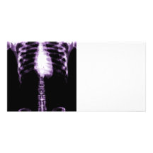X-RAY SKELETON TORSO RIBS - PURPLE PHOTO GREETING CARD