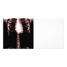 X-RAY SKELETON TORSO RIBS - RED CUSTOM PHOTO CARD