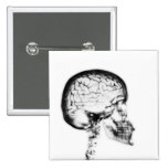 X-RAY SKULL BRAIN - BLACK & WHITE buttons
