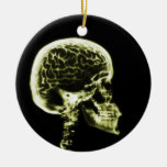 X-RAY SKULL BRAIN - BLACK & YELLOW CHRISTMAS TREE ORNAMENT