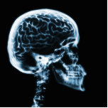 X-RAY SKULL BRAIN - BLUE PHOTO CUTOUT