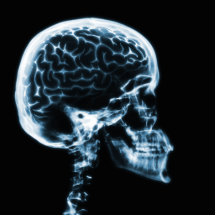 X-RAY SKULL BRAIN - BLUE PHOTO CUTOUT