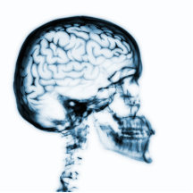 X-RAY SKULL BRAIN - BLUE PHOTO CUTOUTS