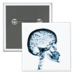 X-RAY SKULL BRAIN - BLUE buttons