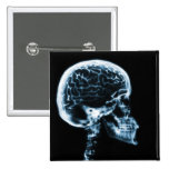 X-RAY SKULL BRAIN - BLUE buttons