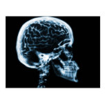 X-RAY SKULL BRAIN - BLUE POST CARD