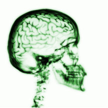 X-RAY SKULL BRAIN - GREEN ACRYLIC CUT OUT