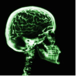 X-RAY SKULL BRAIN - GREEN CUT OUTS