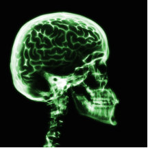 X-RAY SKULL BRAIN - GREEN CUT OUTS