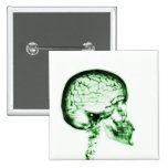 X-RAY SKULL BRAIN - GREEN buttons