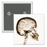 X-RAY SKULL BRAIN - ORANGE buttons