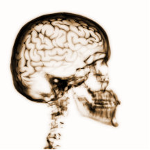 X-RAY SKULL BRAIN - ORANGE CUT OUTS