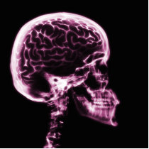 X-RAY SKULL BRAIN - PINK