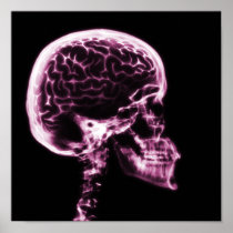 X-RAY SKULL BRAIN - PINK