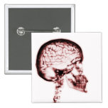 X-RAY SKULL BRAIN - RED buttons