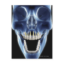 X-ray style look at human teeth post cards