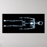X-Ray Vision Blue Single Skeleton Print