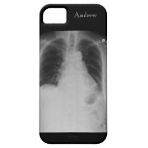 X Ray w-name ~ iPhone 5 CaseMate case