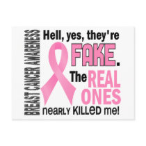 Yes, They Are Fake 1.1 Breast Cancer