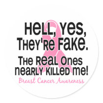 Yes, They Are Fake 2.1 Breast Cancer