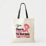YES They're fake....My real ones tried to kill me Tote Bags