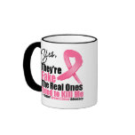 YES They're fake....My real ones tried to kill me Mugs