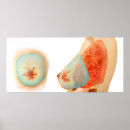 Search for human skin posters Medicine