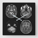 Search for brain clocks Anatomy