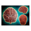 Recherche de lobe cartes postales Médecine