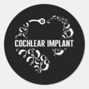 Search for implant stickers Asl