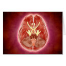 Search for brain stem 3d