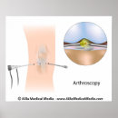 Search for orthopaedic posters Orthopedic