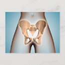 Search for pelvic Hip