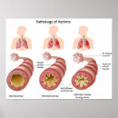 Search for asthma Doctor