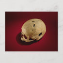 Search for ancient practice Trepanation