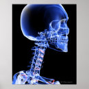 Recherche de cou humain posters Tête humaine