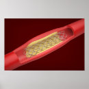 Search for blood vessels posters Heart