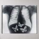 Recherche de estomac posters Abdomen