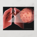 Recherche de corps humain cartes postales Front