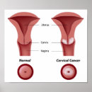 Recherche de gynécologue posters Médecin