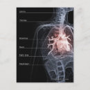Recherche de diagrammes cartes postales Coeur