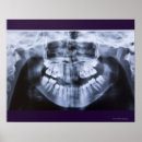 Search for dental posters Close up