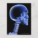 Search for human head postcards Part