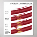 Search for heart attack posters Disease