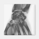 Search for normal photography X ray image
