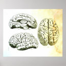 Search for brain posters Medical