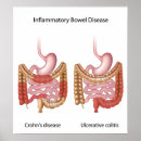 Recherche de crohn posters Chronique